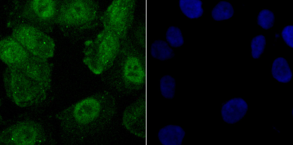 IF(ICC) staining with CREB1 (Ser133) (5F2) Monoclonal Antibody (bsm-54334R) at 1:100 in HUVEC cells (green). The nuclear counterstain is DAPI (blue). Cells were fixed in paraformaldehyde, permeabilized with 0.25% Triton X100/PBS.