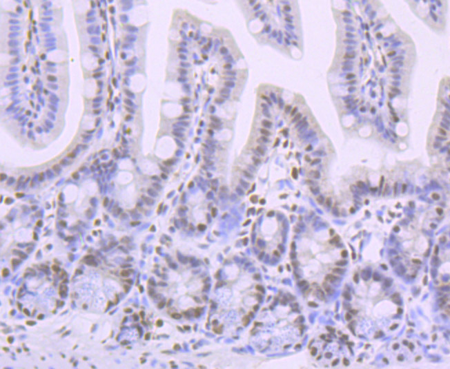 Paraformaldehyde-fixed and paraffin-embedded Mouse Colon tissue incubated with CREB1 (Ser133) (5F2) Monoclonal Antibody (bsm-54334R) at 1:100, overnight at 4°C, followed by a conjugated secondary antibody and DAB staining. Counterstained with hematoxylin.