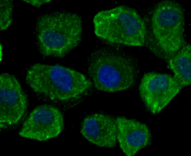 IF(ICC) staining with CD46 (4C3) Monoclonal Antibody (bsm-54335R) at 1:100 in HUVEC cells (green). The nuclear counterstain is DAPI (blue). Cells were fixed in paraformaldehyde, permeabilized with 0.25% Triton X100/PBS.