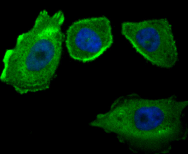 IF(ICC) staining with CD46 (4C3) Monoclonal Antibody (bsm-54335R) at 1:100 in PC-3M cells (green). The nuclear counterstain is DAPI (blue). Cells were fixed in paraformaldehyde, permeabilized with 0.25% Triton X100/PBS.