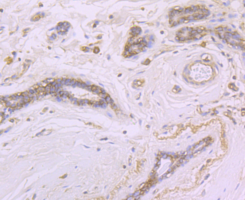 Paraformaldehyde-fixed and paraffin-embedded Human Breast tissue incubated with CD46 (4C3) Monoclonal Antibody (bsm-54335R) at 1:100, overnight at 4°C, followed by a conjugated secondary antibody and DAB staining. Counterstained with hematoxylin.