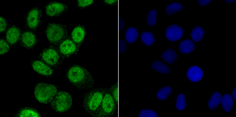 IF(ICC) staining with CAMK4 (3F11) Monoclonal Antibody (bsm-54336R) at 1:100 in Hela cells (green). The nuclear counterstain is DAPI (blue). Cells were fixed in paraformaldehyde, permeabilized with 0.25% Triton X100/PBS.