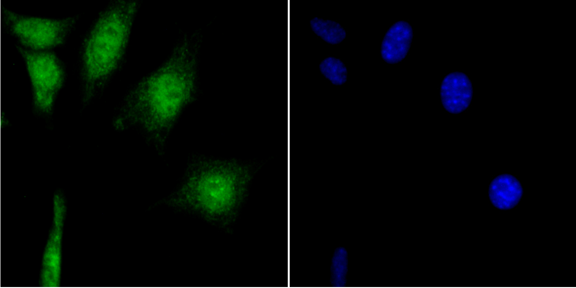 IF(ICC) staining with CAMK4 (3F11) Monoclonal Antibody (bsm-54336R) at 1:100 in SH-SY5Y cells (green). The nuclear counterstain is DAPI (blue). Cells were fixed in paraformaldehyde, permeabilized with 0.25% Triton X100/PBS.