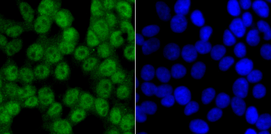 IF(ICC) staining with CAMK4 (3F11) Monoclonal Antibody (bsm-54336R) at 1:100 in 293T cells (green). The nuclear counterstain is DAPI (blue). Cells were fixed in paraformaldehyde, permeabilized with 0.25% Triton X100/PBS.