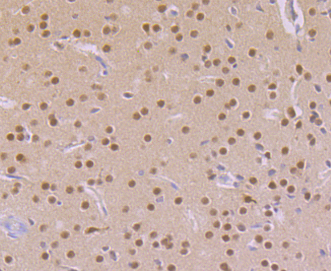 Paraformaldehyde-fixed and paraffin-embedded Mouse Brain tissue incubated with CAMK4 (3F11) Monoclonal Antibody (bsm-54336R) at 1:100, overnight at 4°C, followed by a conjugated secondary antibody and DAB staining. Counterstained with hematoxylin.