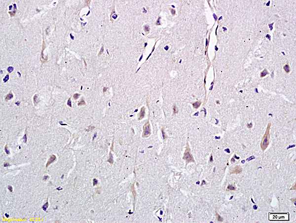 Formalin-fixed and paraffin embedded rat brain labeled with Anti-CD146/MCAM Polyclonal Antibody, Unconjugated (bs-1618R) at 1:400 followed by conjugation to the secondary antibody and DAB staining