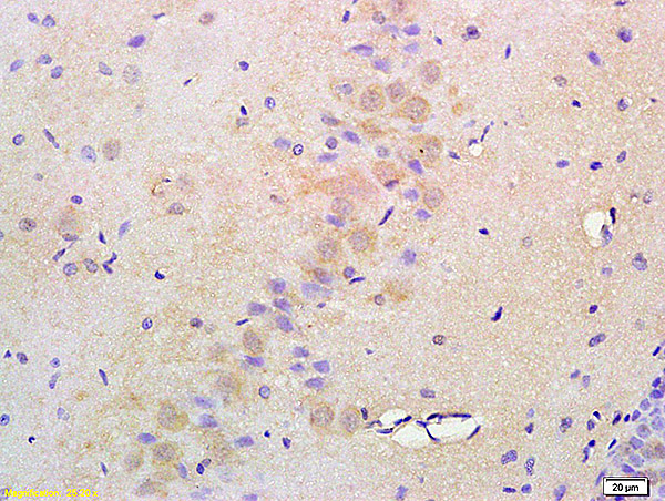 Formalin-fixed and paraffin embedded rat brain labeled with Anti-ATF6 Polyclonal Antibody, Unconjugated (bs-1634R) at 1:200 followed by conjugation to the secondary antibody and DAB staining