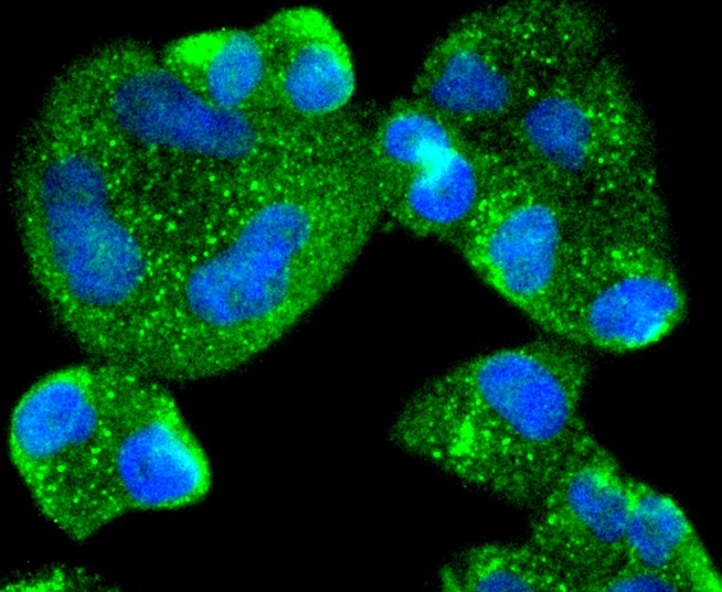 IF(ICC) staining with AGR2 (3F8) Monoclonal Antibody (bsm-52594R) at 1:300 in HeLa cells (green). The nuclear counterstain is DAPI (blue). Cells were fixed in paraformaldehyde, permeabilized with 0.25% Triton X100/PBS.
