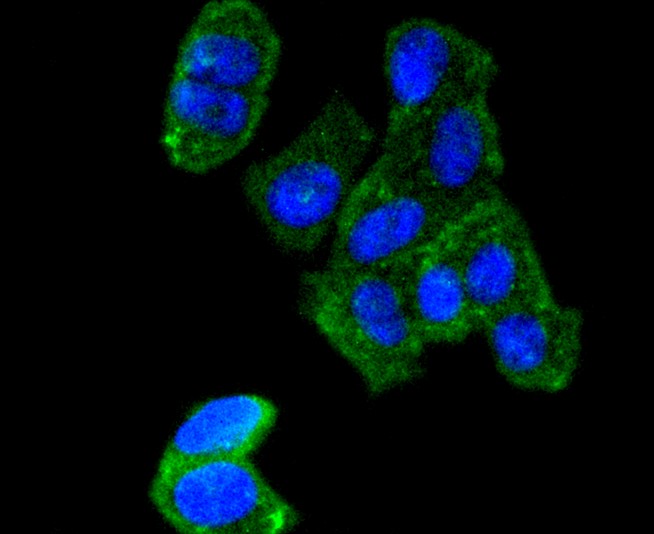 IF(ICC) staining with AGR2 (3F8) Monoclonal Antibody (bsm-52594R) at 1:300 in MCF-7 cells (green). The nuclear counterstain is DAPI (blue). Cells were fixed in paraformaldehyde, permeabilized with 0.25% Triton X100/PBS.