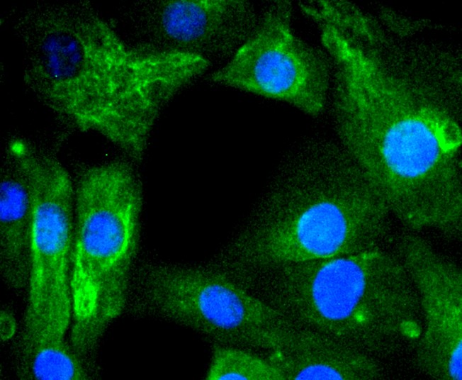 IF(ICC) staining with AGR2 (3F8) Monoclonal Antibody (bsm-52594R) at 1:300 in NIH/3T3 cells (green). The nuclear counterstain is DAPI (blue). Cells were fixed in paraformaldehyde, permeabilized with 0.25% Triton X100/PBS.