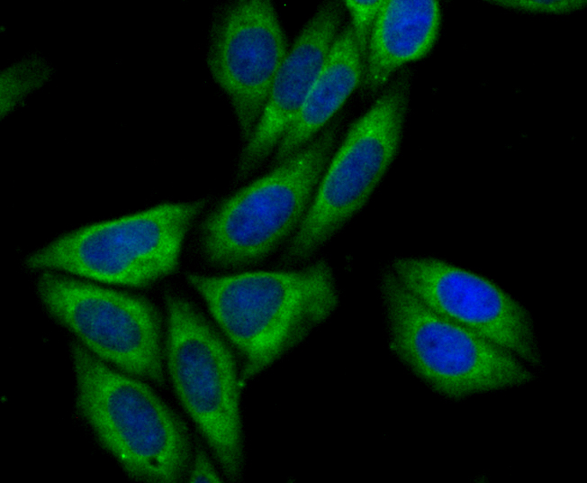 IF(ICC) staining with Syntrophin alpha 1 (2A1) Monoclonal Antibody (bsm-54351R) at 1:100 in SiHa cells (green). The nuclear counterstain is DAPI (blue). Cells were fixed in paraformaldehyde, permeabilized with 0.25% Triton X100/PBS.