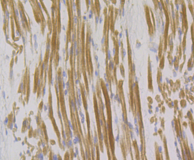 Paraformaldehyde-fixed and paraffin-embedded Human Skeletal Muscle tissue incubated with Syntrophin alpha 1 (2A1) Monoclonal Antibody (bsm-54351R) at 1:100, overnight at 4°C, followed by a conjugated secondary antibody and DAB staining. Counterstained with hematoxylin.