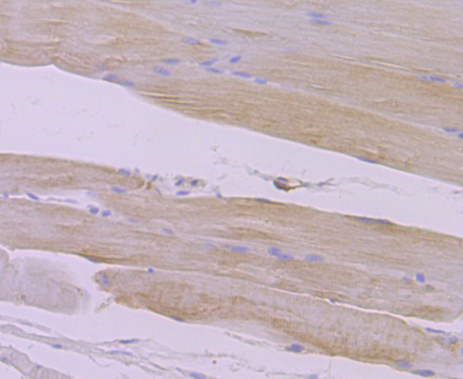 Paraformaldehyde-fixed and paraffin-embedded Mouse Skeletal Muscle tissue incubated with Syntrophin alpha 1 (2A1) Monoclonal Antibody (bsm-54351R) at 1:100, overnight at 4°C, followed by a conjugated secondary antibody and DAB staining. Counterstained with hematoxylin.