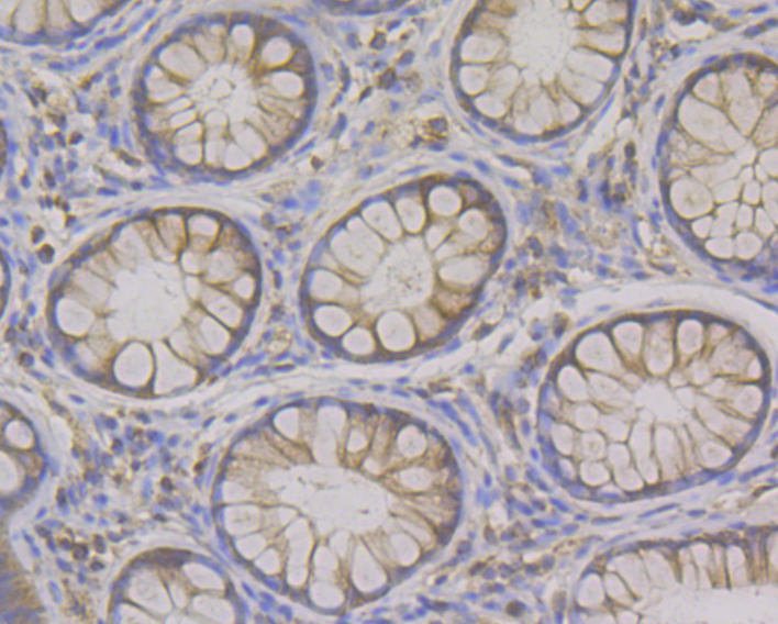 Paraformaldehyde-fixed and paraffin-embedded Human Colon tissue incubated with Syntrophin alpha 1 (2A1) Monoclonal Antibody (bsm-54351R) at 1:100, overnight at 4°C, followed by a conjugated secondary antibody and DAB staining. Counterstained with hematoxylin.