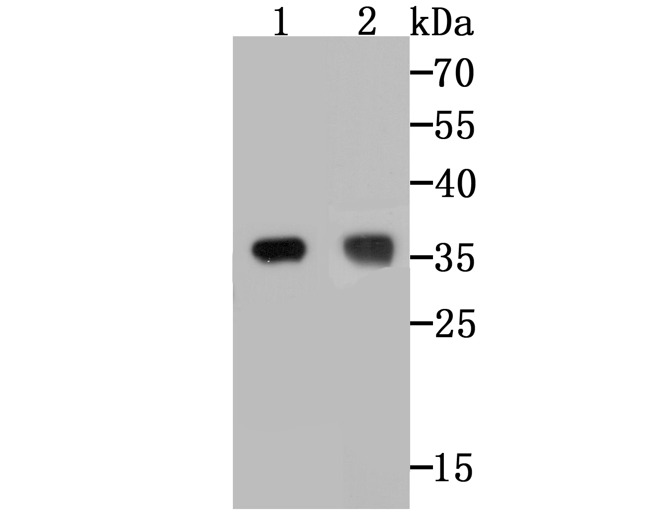 Lane 1: A431 Cells; Lane 2: SK-BR-3 Cells; Probed with TREX1 (6C2) Monoclonal Antibody (bsm-54352R) at 1:500 overnight at 4°C followed by a conjugated secondary antibody for 60 minutes at 37°C.