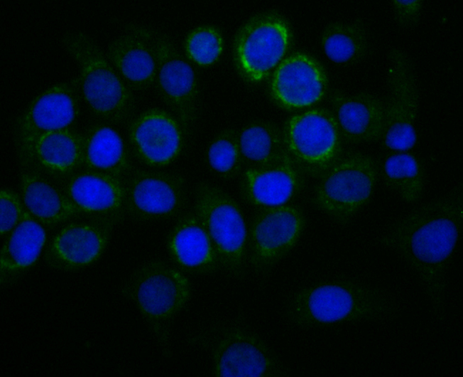 IF(ICC) staining with TREX1 (6C2) Monoclonal Antibody (bsm-54352R) at 1:100 in LOVO cells (green). The nuclear counterstain is DAPI (blue). Cells were fixed in paraformaldehyde, permeabilized with 0.25% Triton X100/PBS.