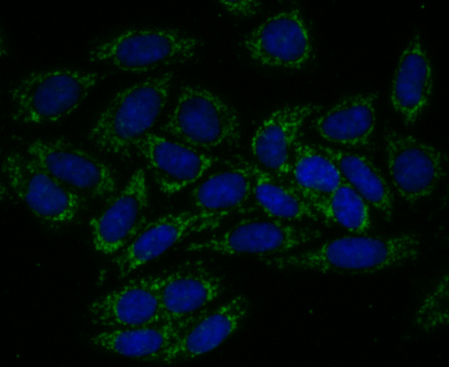 IF(ICC) staining with TREX1 (6C2) Monoclonal Antibody (bsm-54352R) at 1:100 in SiHa cells (green). The nuclear counterstain is DAPI (blue). Cells were fixed in paraformaldehyde, permeabilized with 0.25% Triton X100/PBS.