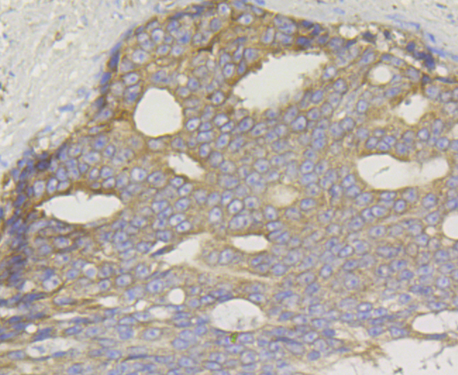 Paraformaldehyde-fixed and paraffin-embedded Human Prostate tissue incubated with TREX1 (6C2) Monoclonal Antibody (bsm-54352R) at 1:100, overnight at 4°C, followed by a conjugated secondary antibody and DAB staining. Counterstained with hematoxylin.