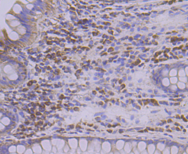 Paraformaldehyde-fixed and paraffin-embedded Human Colon tissue incubated with TREX1 (6C2) Monoclonal Antibody (bsm-54352R) at 1:100, overnight at 4°C, followed by a conjugated secondary antibody and DAB staining. Counterstained with hematoxylin.