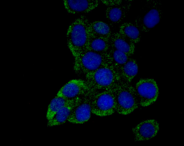 IF(ICC) staining with FBXO5 (4G10) Monoclonal Antibody (bsm-54356R) at 1:100 in LOVO cells (green). The nuclear counterstain is DAPI (blue). Cells were fixed in paraformaldehyde, permeabilized with 0.25% Triton X100/PBS. IF(ICC) staining with FBXO5 (4G10) Monoclonal Antibody (bsm-54356R) at 1:100 in LOVO cells (green). The nuclear counterstain is DAPI (blue). Cells were fixed in paraformaldehyde, permeabilized with 0.25% Triton X100/PBS.