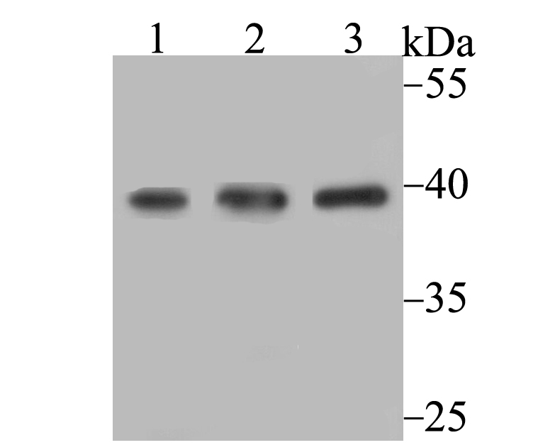Lane 1: SiHa Cells; Lane 2: K562 Cells; Lane 3: 293 Cells Probed with SAE1 (1F1) Monoclonal Antibody (bsm-54358R) at 1:1000 overnight at 4°C followed by a conjugated secondary antibody for 60 minutes at 37°C. Lane 1: SiHa Cells; Lane 2: K562 Cells; Lane 3: 293 Cells Probed with SAE1 (1F1) Monoclonal Antibody (bsm-54358R) at 1:1000 overnight at 4°C followed by a conjugated secondary antibody for 60 minutes at 37°C.
