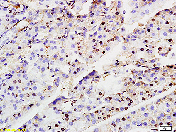 Formalin-fixed and paraffin embedded rat pancreas labeled with Anti-ASF1A Polyclonal Antibody, Unconjugated (bs-3777R) at 1:200 followed by conjugation to the secondary antibody and DAB staining