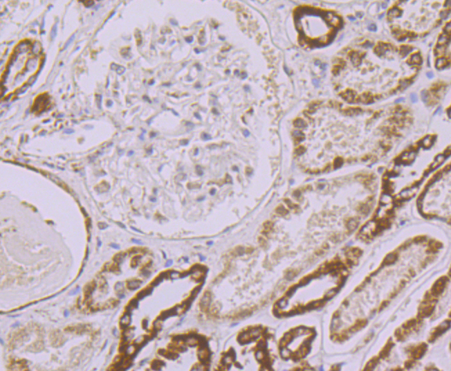 Paraformaldehyde-fixed and paraffin-embedded Human Kidney tissue incubated with UQCRFS1 (10C1) Monoclonal Antibody (bsm-54363R) at 1:100, overnight at 4°C, followed by a conjugated secondary antibody and DAB staining. Counterstained with hematoxylin.