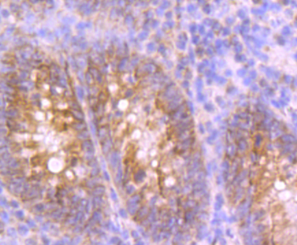 Paraformaldehyde-fixed and paraffin-embedded Human Appendix tissue incubated with UQCRFS1 (10C1) Monoclonal Antibody (bsm-54363R) at 1:100, overnight at 4°C, followed by a conjugated secondary antibody and DAB staining. Counterstained with hematoxylin.