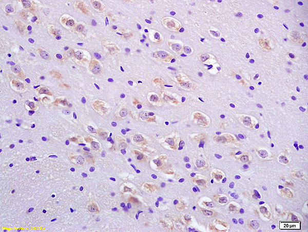 Formalin-fixed and paraffin embedded rat brain labeled with Anti-AANAT Polyclonal Antibody, Unconjugated (bs-3914R) at 1:200 followed by conjugation to the secondary antibody and DAB staining