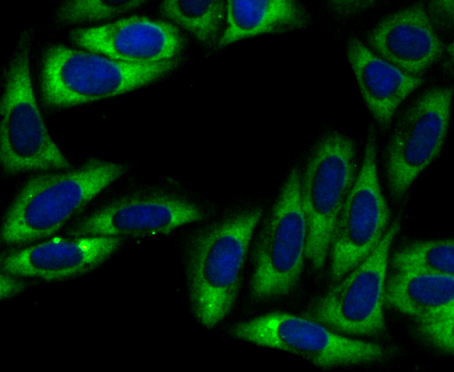 IF(ICC) staining with UQCRFS1 (10C1) Monoclonal Antibody (bsm-54363R) at 1:100 in SiHa cells (green). The nuclear counterstain is DAPI (blue). Cells were fixed in paraformaldehyde, permeabilized with 0.25% Triton X100/PBS.