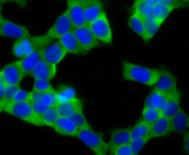 IF(ICC) staining with UQCRFS1 (10C1) Monoclonal Antibody (bsm-54363R) at 1:100 in 293T cells (green). The nuclear counterstain is DAPI (blue). Cells were fixed in paraformaldehyde, permeabilized with 0.25% Triton X100/PBS.