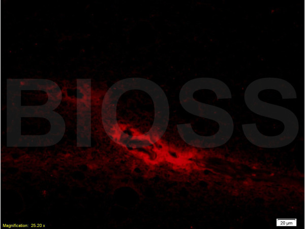 Formalin-fixed and paraffin embedded human brain tissue labeled with Anti-AANAT Polyclonal Antibody, Unconjugated (bs-3914R) at 1:200 followed by conjugation to the secondary antibody Goat Anti-Rabbit IgG, PE conjugated(bs-0295G-PE) used at 1:200 dilution for 40 minutes at 37°C