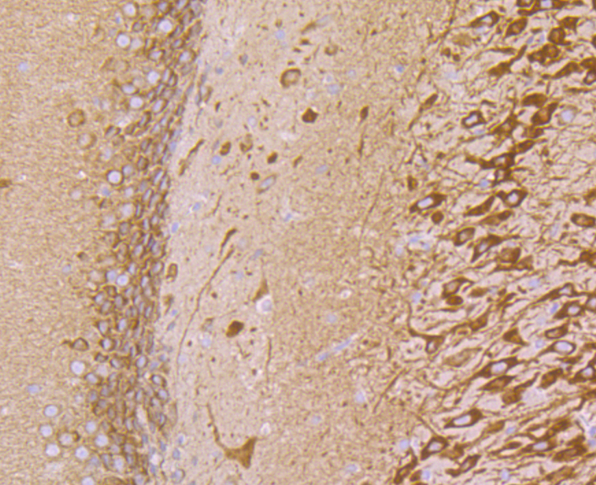 Paraformaldehyde-fixed and paraffin-embedded Rat Brain tissue incubated with VAMP3 (8A3) Monoclonal Antibody (bsm-54366R) at 1:100, overnight at 4°C, followed by a conjugated secondary antibody and DAB staining. Counterstained with hematoxylin.