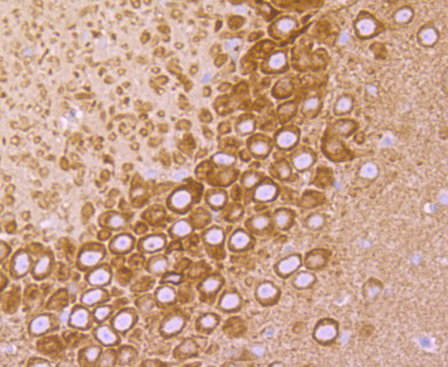 Paraformaldehyde-fixed and paraffin-embedded Rat Hippocampus tissue incubated with VAMP3 (8A3) Monoclonal Antibody (bsm-54366R) at 1:100, overnight at 4°C, followed by a conjugated secondary antibody and DAB staining. Counterstained with hematoxylin.
