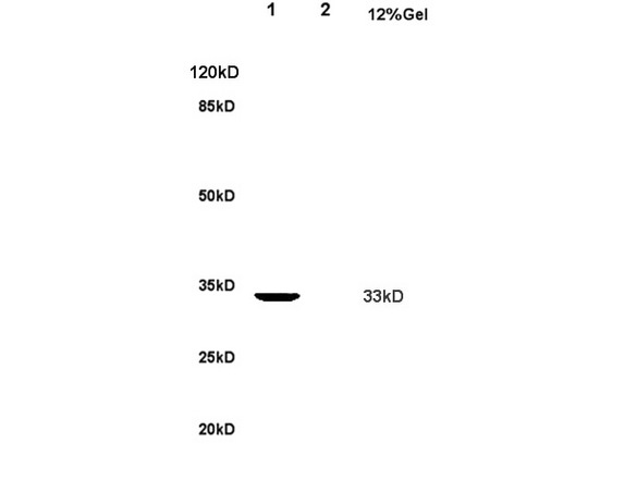 L1 rat kidney lysate L2 rat brain lysates probed with Anti Nucleophosmin Polyclonal Antibody, Unconjugated (bs-4757R) at 1:200 overnight at 4˚C. Followed by conjugation to secondary antibody (bs-0295G-HRP) at 1:3000 for 90 min at 37˚C. Predicted band 33kD. Observed band size: 33kD