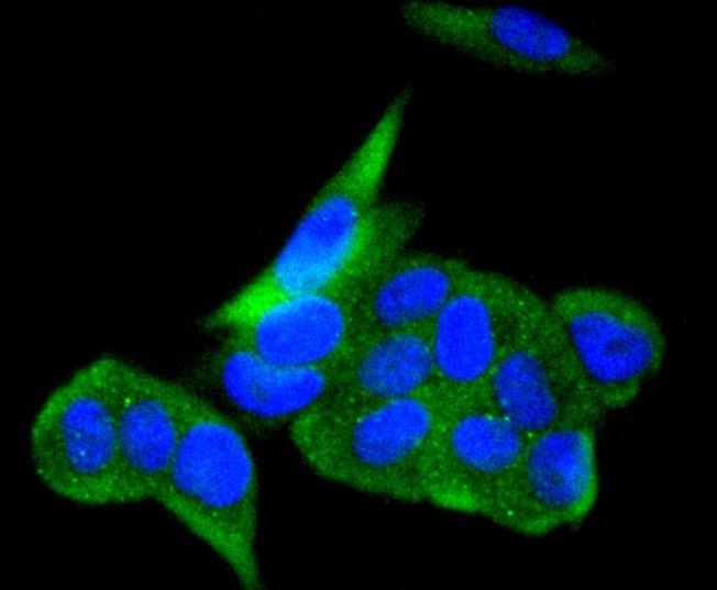 IF(ICC) staining with Angiotensin Converting Enzyme 2 (3F1) Monoclonal Antibody (bsm-52614R) at 1:300 in MCF-7 cells (green). The nuclear counterstain is DAPI (blue). Cells were fixed in paraformaldehyde, permeabilized with 0.25% Triton X100\/PBS. 