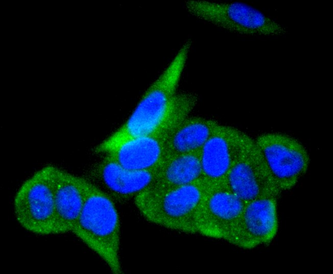 IF(ICC) staining with Angiotensin Converting Enzyme 2 (3F1) Monoclonal Antibody (bsm-52614R) at 1:300 in MCF-7 cells (green). The nuclear counterstain is DAPI (blue). Cells were fixed in paraformaldehyde, permeabilized with 0.25% Triton X100/PBS.