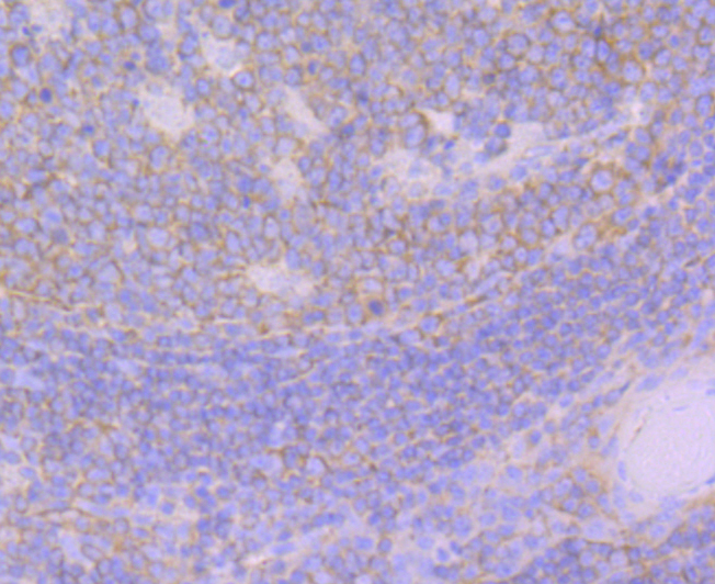 Paraformaldehyde-fixed and paraffin-embedded Human Tonsil tissue incubated with ARHGEF2 (9D4) Monoclonal Antibody (bsm-54369R) at 1:100, overnight at 4°C, followed by a conjugated secondary antibody and DAB staining. Counterstained with hematoxylin.
