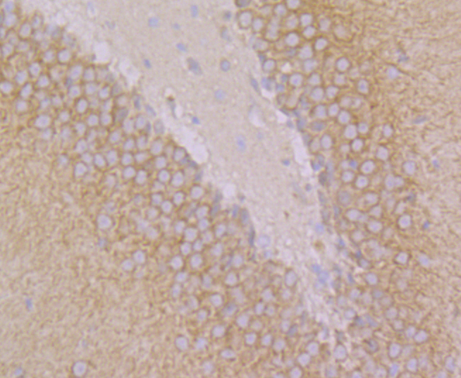 Paraformaldehyde-fixed and paraffin-embedded Rat Brain tissue incubated with ARHGEF2 (9D4) Monoclonal Antibody (bsm-54369R) at 1:100, overnight at 4°C, followed by a conjugated secondary antibody and DAB staining. Counterstained with hematoxylin.