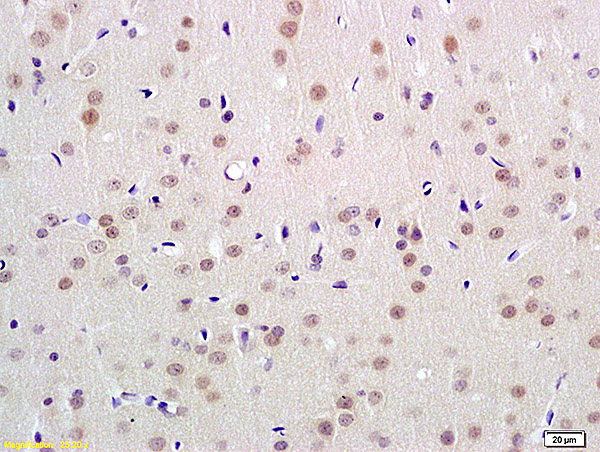 Formalin-fixed and paraffin embedded rat brain labeled with Anti-UBL7 Polyclonal Antibody, Unconjugated (bs-4050R) at 1:100 followed by conjugation to the secondary antibody and DAB staining