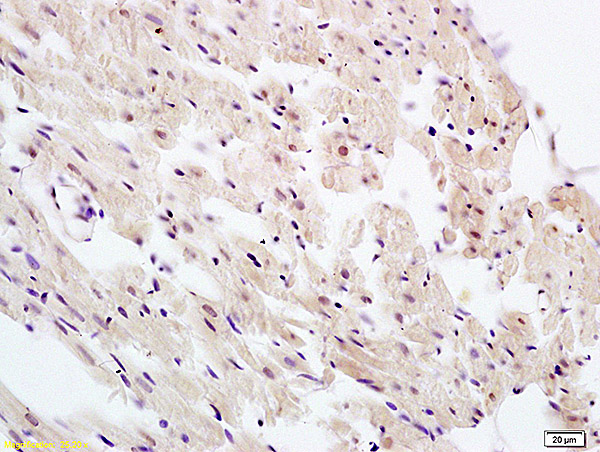 Formalin-fixed and paraffin embedded rat heart labeled with Anti-UBL7 Polyclonal Antibody, Unconjugated (bs-4050R) at 1:100 followed by conjugation to the secondary antibody and DAB staining