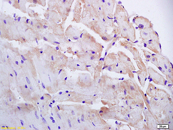Formalin-fixed and paraffin embedded mouse heart labeled with Anti-PAP2B Polyclonal Antibody, Unconjugated (bs-4127R) at 1:200 followed by conjugation to the secondary antibody and DAB staining Formalin-fixed and paraffin embedded mouse heart labeled with Anti-PAP2B Polyclonal Antibody, Unconjugated (bs-4127R) at 1:200 followed by conjugation to the secondary antibody and DAB staining