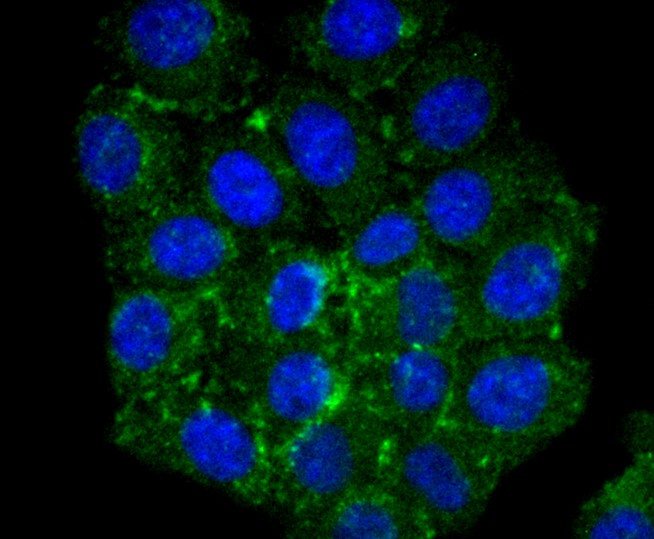 IF(ICC) staining with CPT2 (3B10) Monoclonal Antibody (bsm-52621R) at 1:100 in HepG2 cells (green). The nuclear counterstain is DAPI (blue). Cells were fixed in paraformaldehyde, permeabilized with 0.25% Triton X100/PBS.