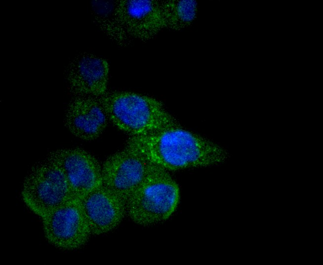 IF(ICC) staining with CPT2 (3B10) Monoclonal Antibody (bsm-52621R) at 1:100 in SW480 cells (green). The nuclear counterstain is DAPI (blue). Cells were fixed in paraformaldehyde, permeabilized with 0.25% Triton X100/PBS.