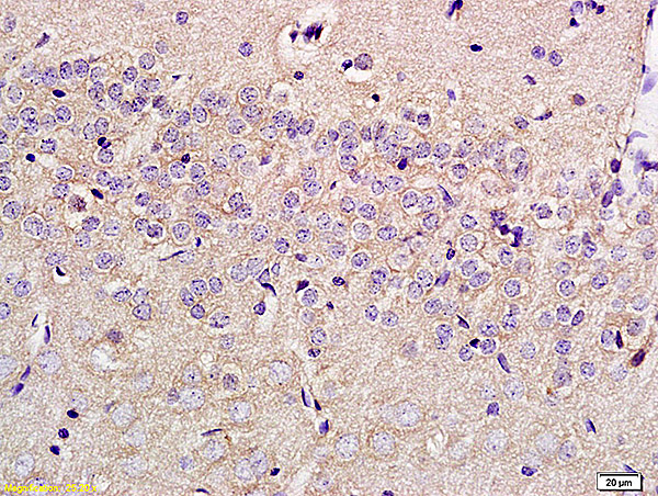 Formalin-fixed and paraffin embedded rat brain labeled with Anti-SLC29A4 Polyclonal Antibody, Unconjugated (bs-4176R) at 1:200 followed by conjugation to the secondary antibody and DAB staining