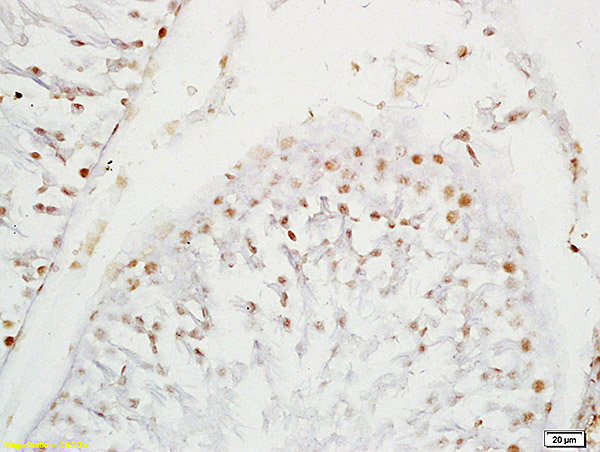Formalin-fixed and paraffin embedded rat testis labeled with Anti-SOX9/SRA1 Polyclonal Antibody, Unconjugated (bs-4177R) at 1:200 followed by conjugation to the secondary antibody and DAB staining