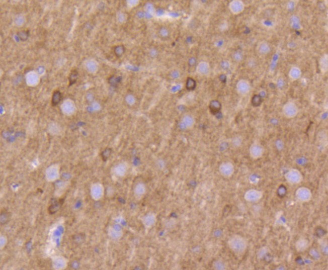 Paraformaldehyde-fixed and paraffin-embedded Rat brain tissue incubated with Kv1.1 potassium channel (5B8) Monoclonal Antibody (bsm-52626R) at 1:100, overnight at 4°C, followed by a conjugated secondary antibody and DAB staining. Counterstained with hematoxylin.