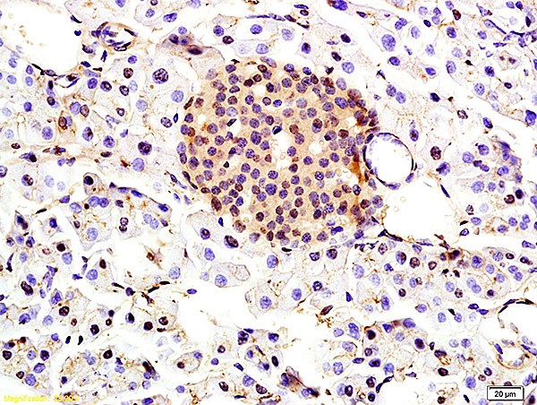 Formalin-fixed and paraffin embedded rat pancreas labeled with Anti-TBRG1 Polyclonal Antibody, Unconjugated (bs-4268R) at 1:200 followed by conjugation to the secondary antibody and DAB staining