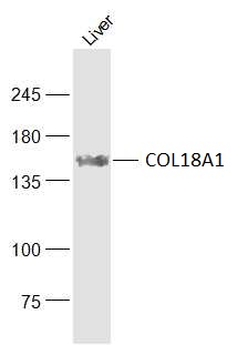 Lane 1: Mouse Liver; Probed with Endostatin Polyclonal Antibody, Unconjugated (bs-0547R) at 1:500, overnight at 4°C followed by incubation with a conjugated secondary antibody for 60 minutes at 37°C.