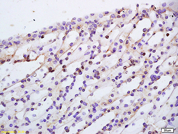 Formalin-fixed and paraffin embedded rat kidney labeled with Anti-TBRG1 Polyclonal Antibody, Unconjugated (bs-4268R) at 1:200 followed by conjugation to the secondary antibody and DAB staining